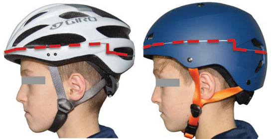 Biomechanics of head injuries and helmet protection