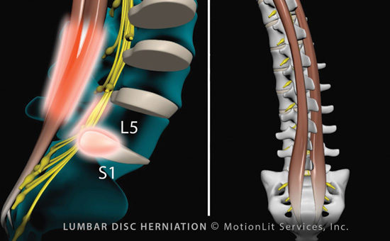 Producing trial-ready animation using experts’ data and analysis