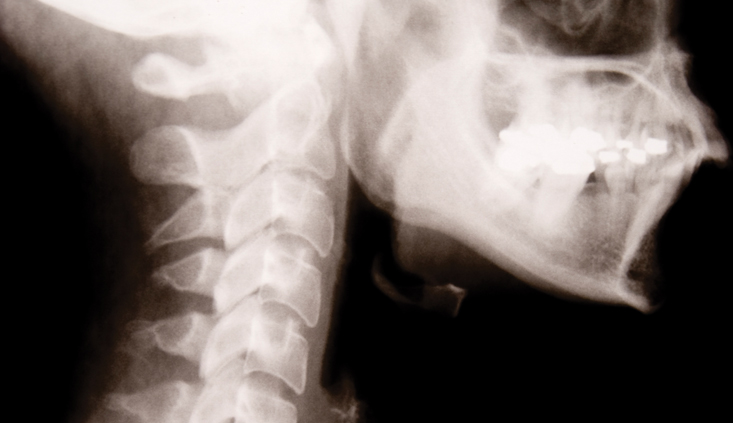 How plaintiff’s pre-existing conditions affect general damages