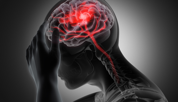 Traumatic-brain-injury experts 101 Traumatic-brain-injury experts 101