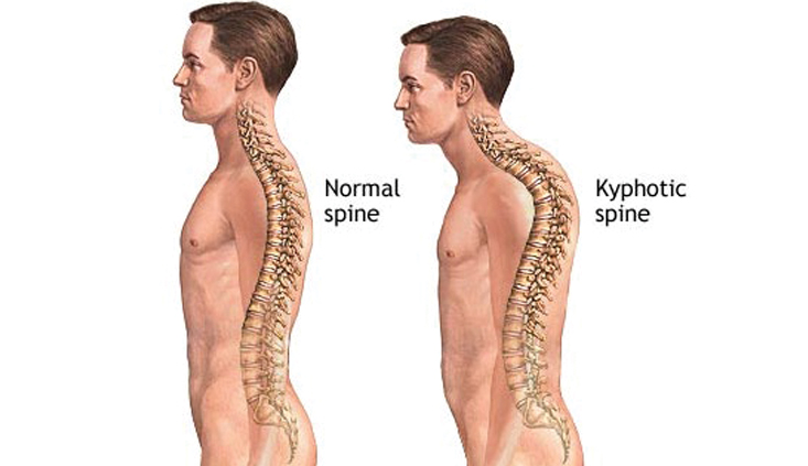 Don’t overlook <em>any</em> of your client’s injuries